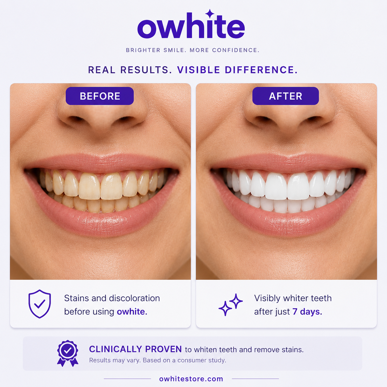 Owhite Teeth Whitening Strips